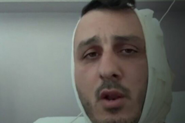 Skandal na plaži u Grčkoj! Sirijac izraelskom turisti otkinuo deo uha