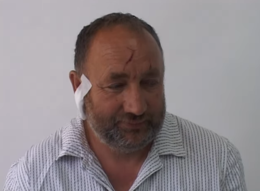 Srbin golim rukama ubio medveda! "On je mene ujedao, a ja njega udarao"