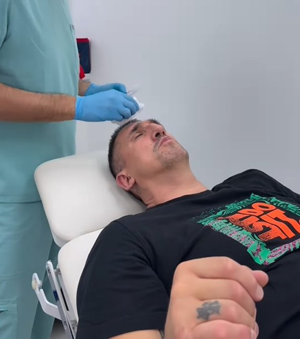 Kristijan Golubović otišao na estetsku korekciju: Odlučio se za promenu! (FOTO)