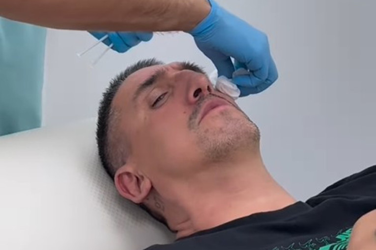 Kristijan Golubović otišao na estetsku korekciju: Odlučio se za promenu! (FOTO)