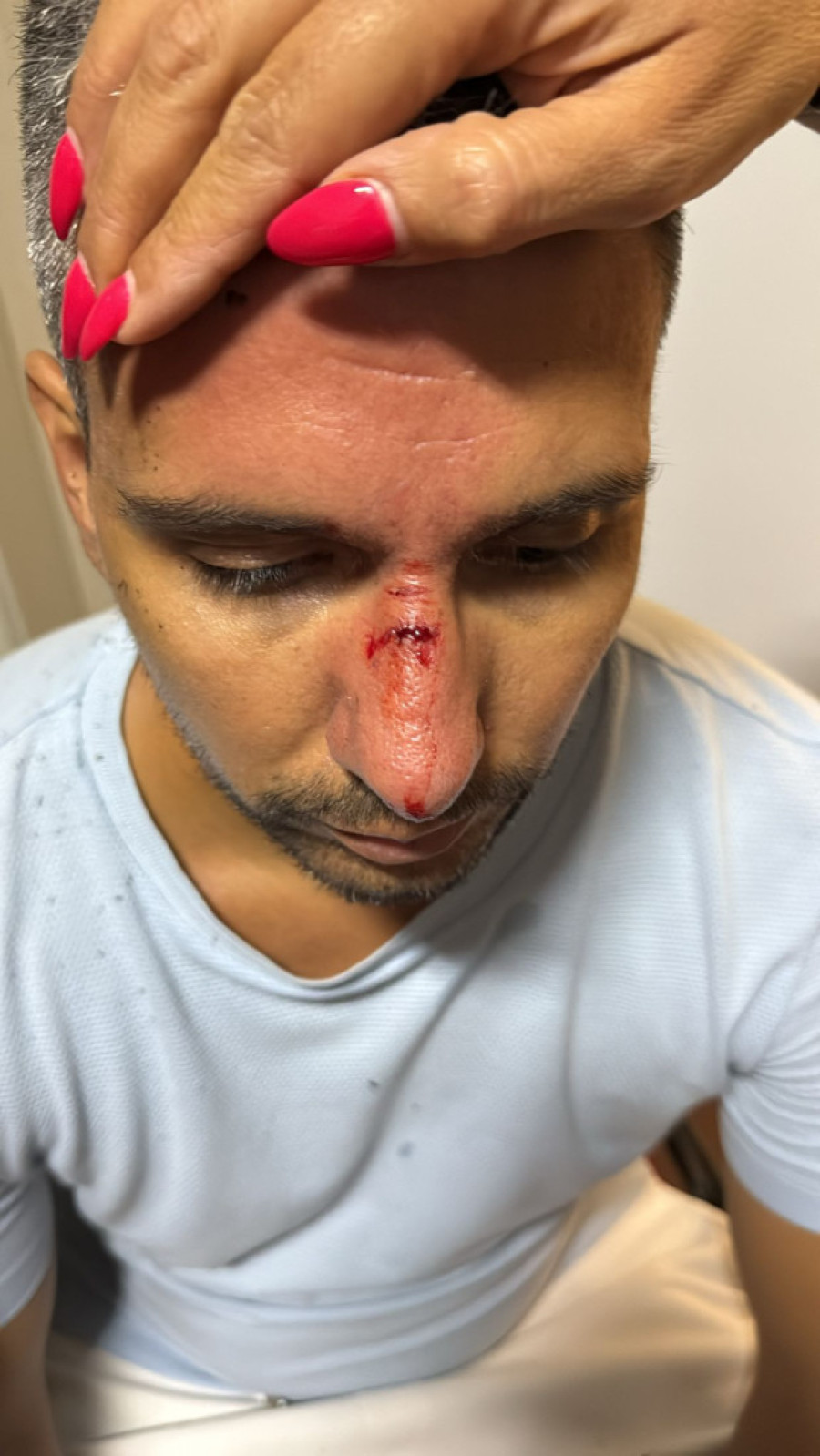 Jezivo nasilje blokadera: Zamalo ubili čoveka u Bačkoj Palanci (FOTO)