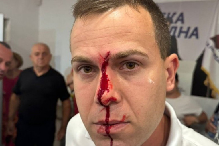 Eskaliralo nasilje blokadera širom Srbije: Vučić otkrio koliko je zgubidana bilo u Beogradu i Novom Sadu (FOTO/VIDEO)