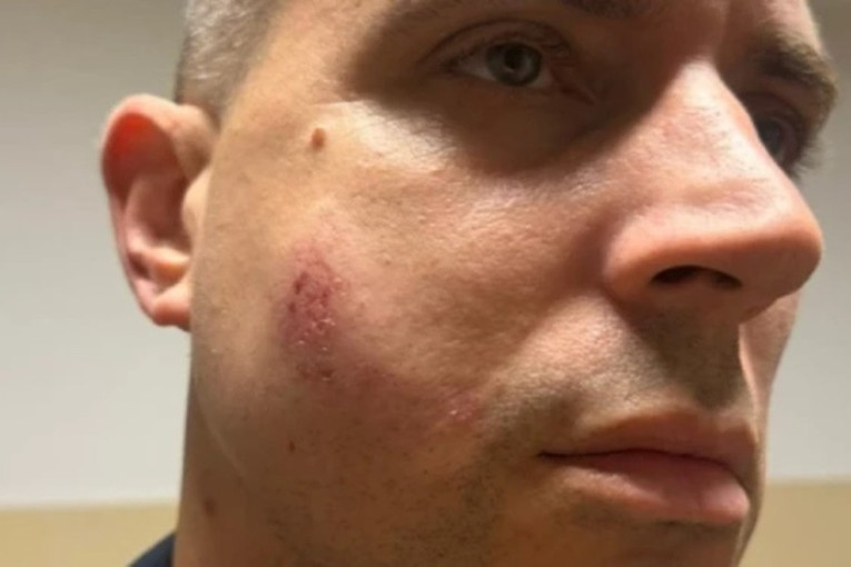 Blokaderi žele građanski rat u Srbiji: Demolirane prostorije SNS u Novom Sadu; topovski udari u Beogradu; obratio se i Vučić (FOTO/VIDEO)