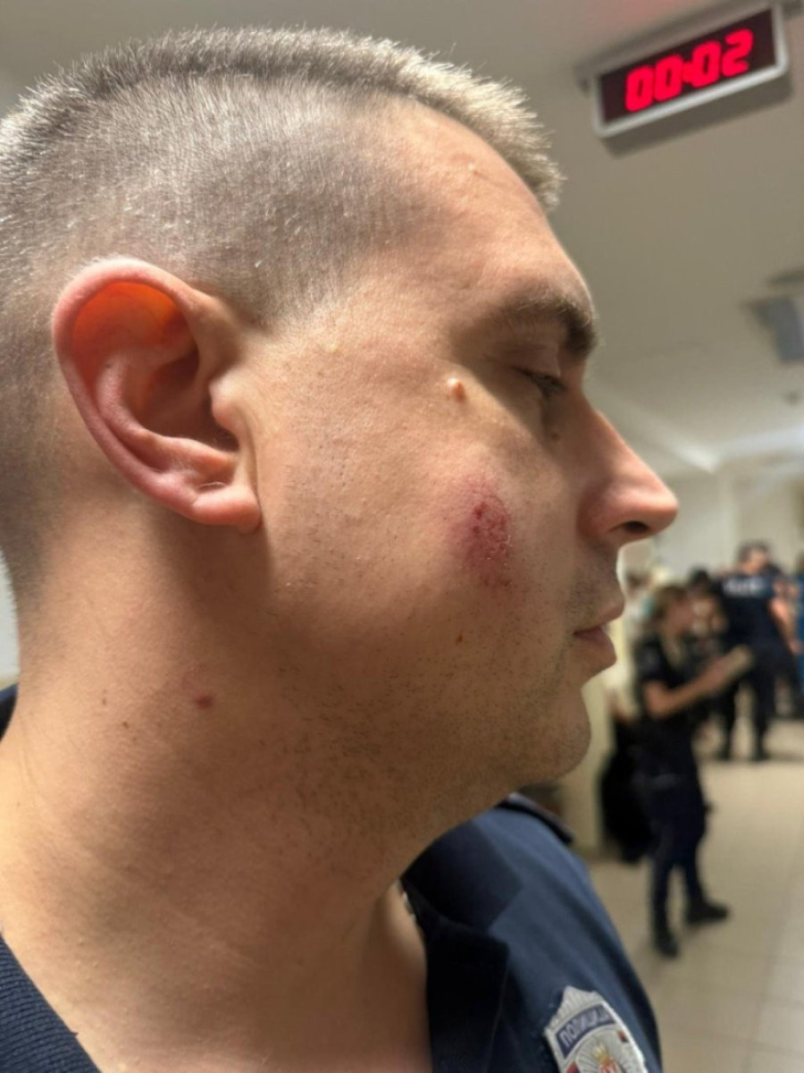 Povređeno sedam policajaca u Pančevu: Jednog od njih blokaderi gađali kamenom u glavu (FOTO)
