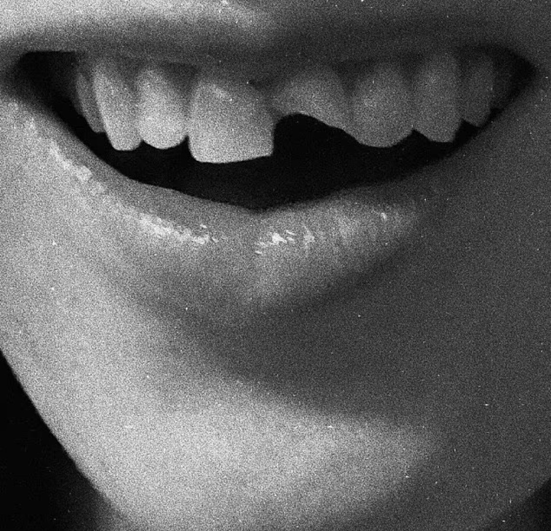 Novi detalji drame! Unuk Džeka Nikolsona devojci polomio zube: Čeka ga žestoka kazna!