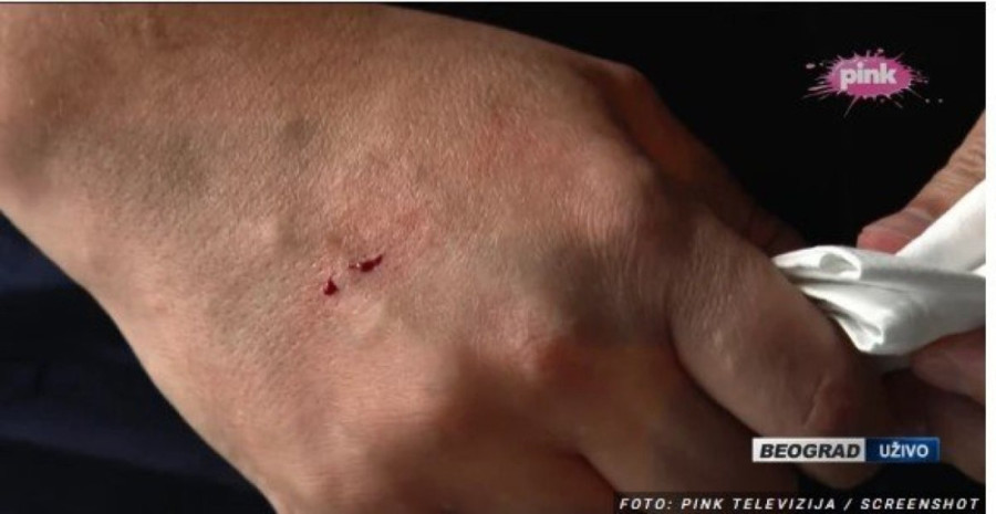 "Izgleda da sam se isekao, nećemo da bežimo": Vučić posekao ruku u Cvijićevoj ulici (FOTO)