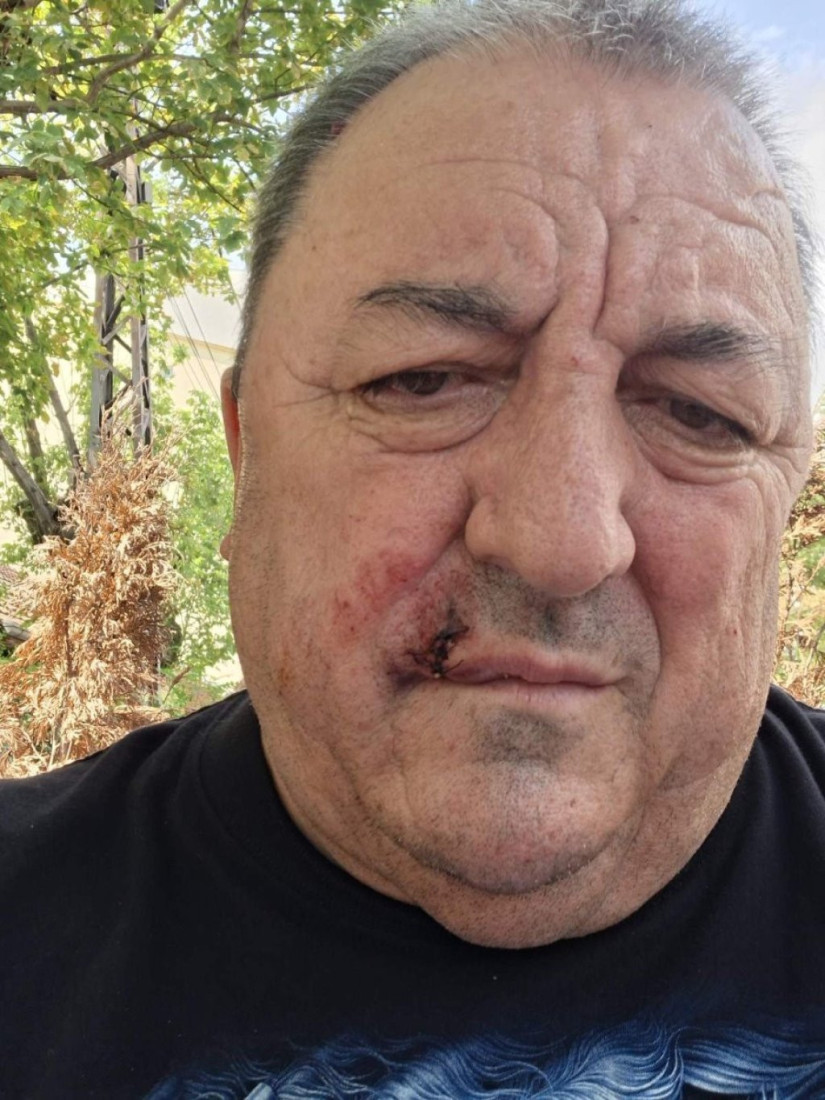 Oglasio se vozač kamenovanog autobusa: Mogao sam da ostanem bez oka, sreća da smo svi živi i zdravi!