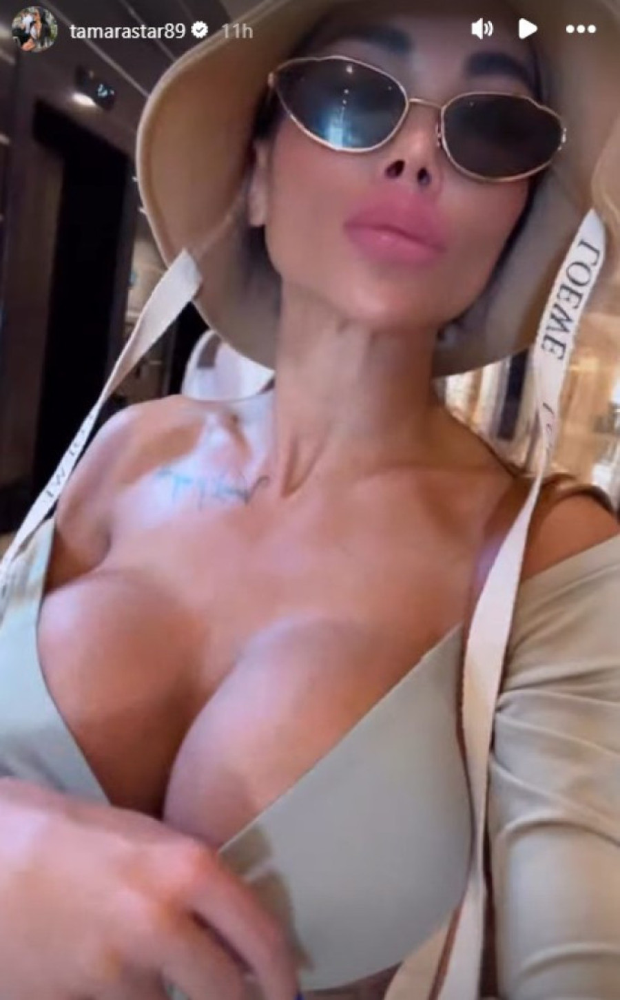 Tamara Đurić se podvrgla još jednom estetskom zahvatu! Blokirala mišić da bi dobila "barbi vrat"