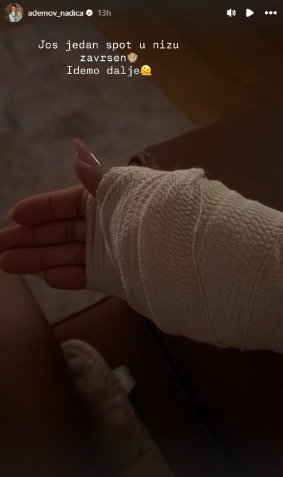 Nadica Ademov pokazala povredu: Fanovi zabrinuti! (FOTO)