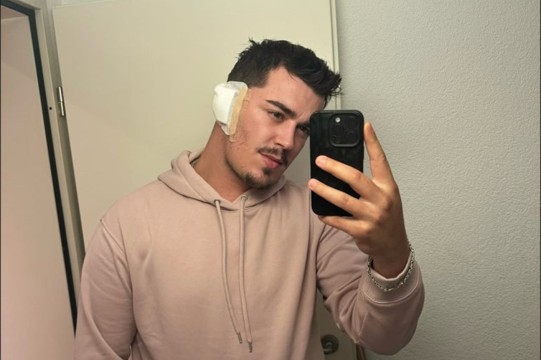 Učesnik "Zvezda Granda" operisao tumor: Otkrio kako se oseća, a zbog ovog poteza mnoge je rasplakao