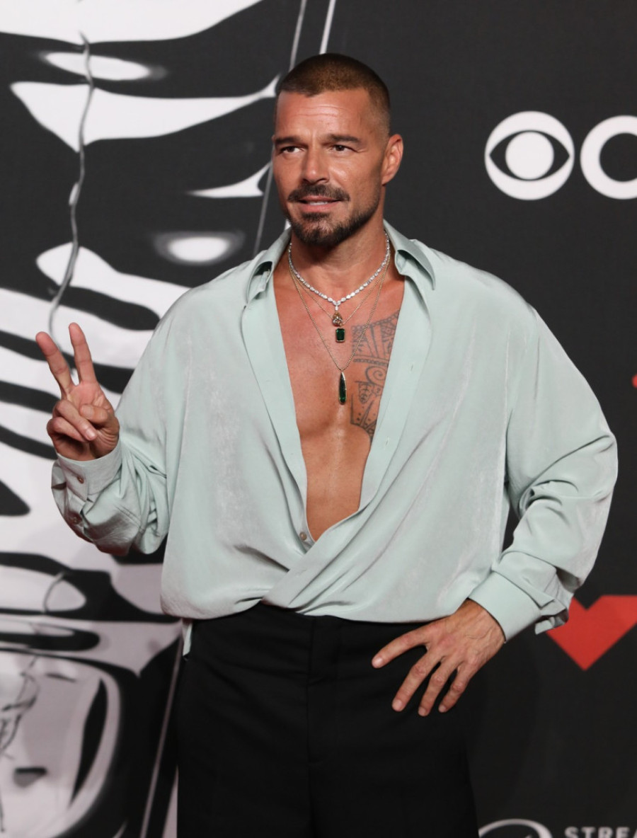 "Ova je prešla igricu s fejsliftingom!" Pevačica na udaru: Šta joj je s licem, je l