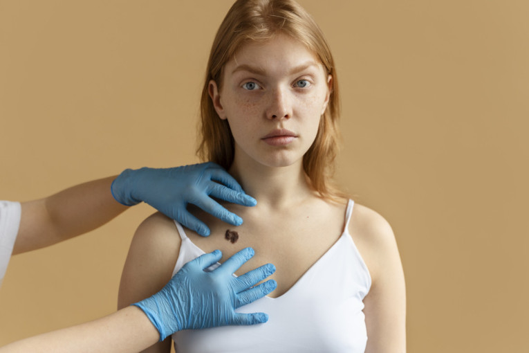 Obratite pažnju: Četiri promene na grudima koje mogu da vode ka raku dojke