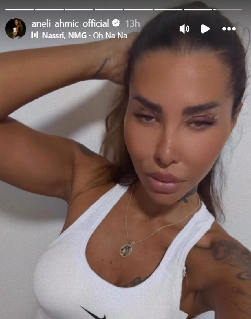 Aneli Ahmić oblepljena flasterima! Bivša rijaliti učesnica se odlučila za potpunu transformaciju! (FOTO)