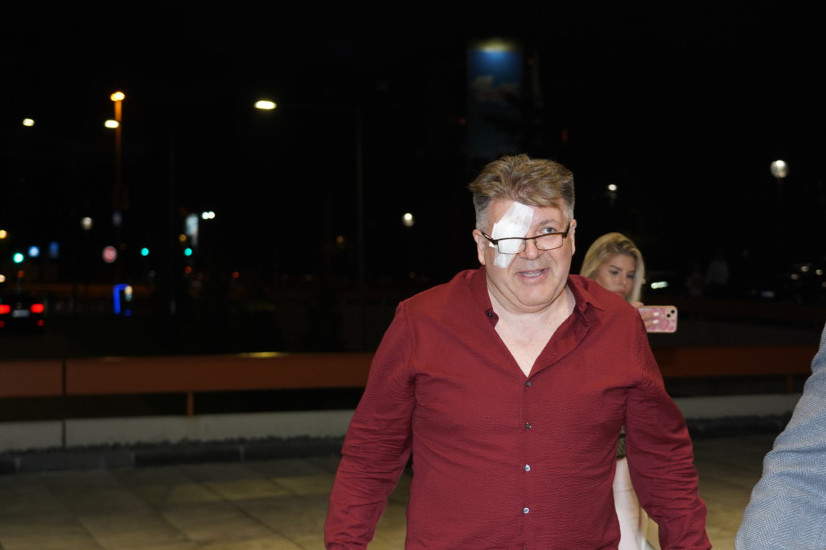 Oko mu skroz zavijeno: Pevač posle operacije došao na rođendan ćerke Saše Matića (VIDEO)