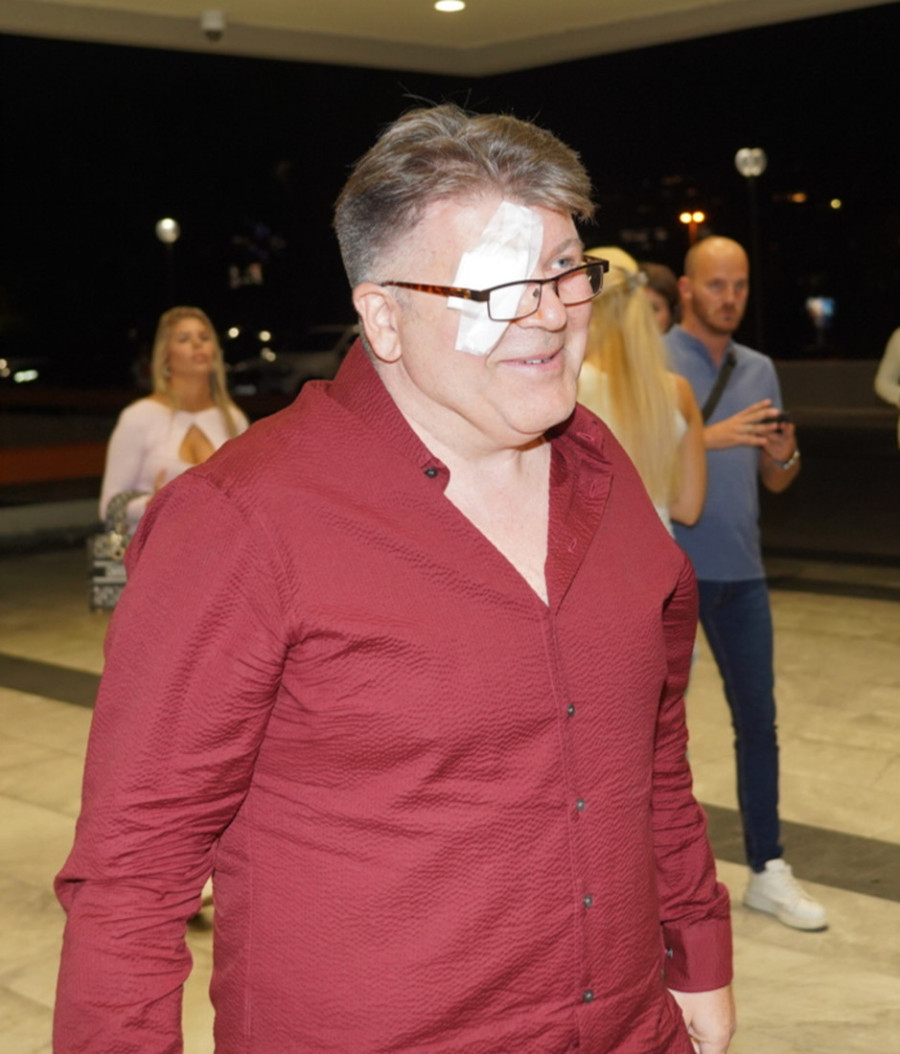 Oko mu skroz zavijeno: Pevač posle operacije došao na rođendan ćerke Saše Matića (VIDEO)