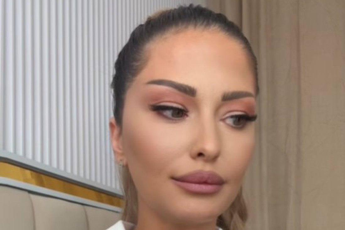 "Imam crvenilo i pečate po koži od stresa!" Ana Radulović prvi put o intimnom snimku sa Gastozom!