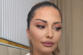 "Imam crvenilo i pečate po koži od stresa!" Ana Radulović prvi put o intimnom snimku sa Gastozom!