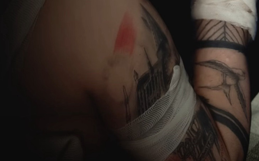 Filip Mitrović nepomično leži u zavojima na podu! Sav u modricama, oči mu pune suza (FOTO)