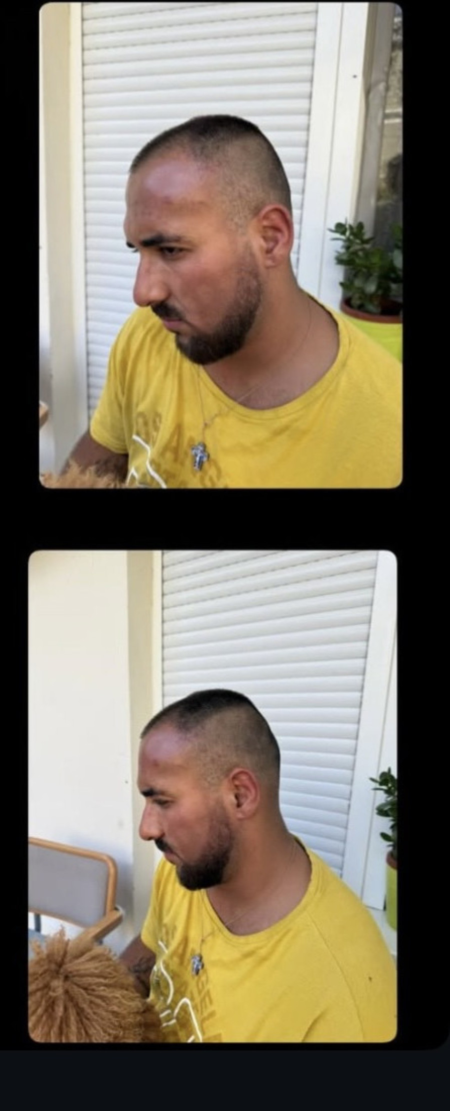 Pretučen Peca Lazić! Njegov rođeni brat podelio uznemirujuće fotografije