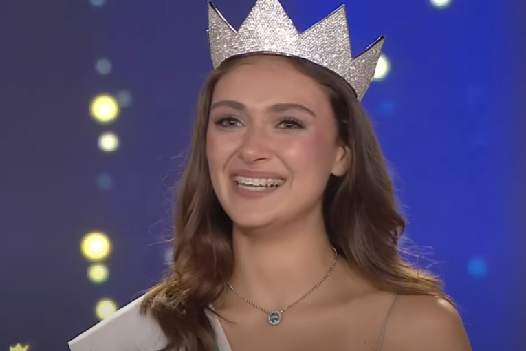 Mis Italije pobedila estetske predrasude: Sa zubnom protezom "pokidala"! (FOTO)