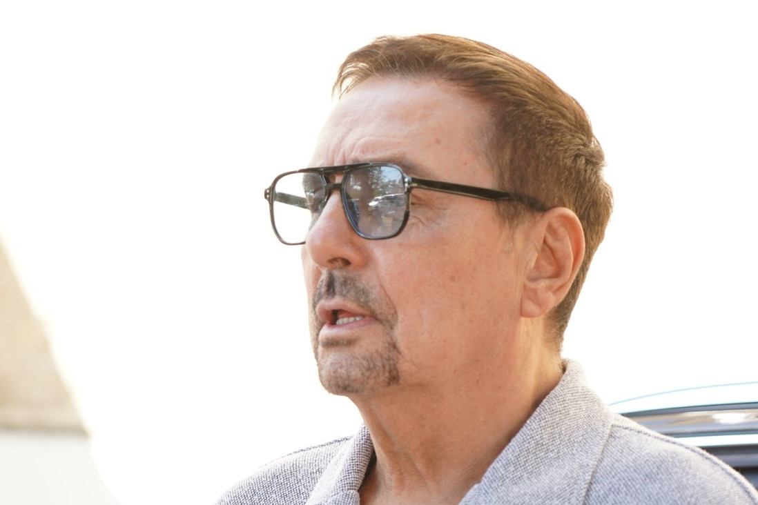 Kebu izujedao pas:  Pevač se pojavio u zavojima, a onda doživeo još jedan peh