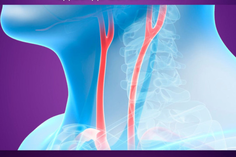 Besplatni ultrazvučni pregledi karotida za građane Novog Beograda