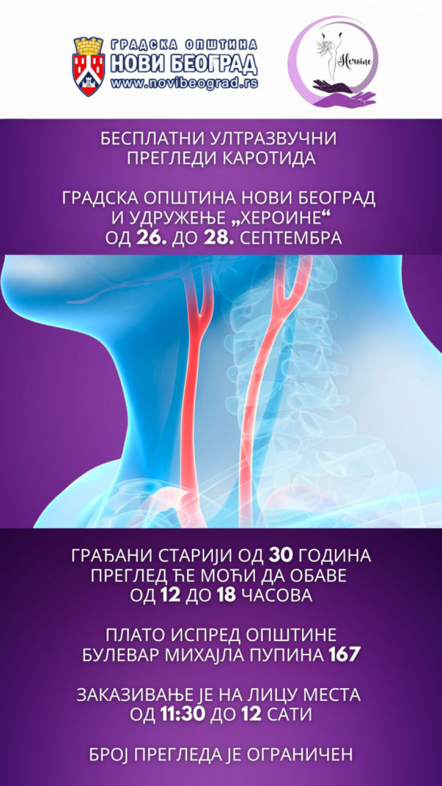 Besplatni ultrazvučni pregledi karotida za građane Novog Beograda