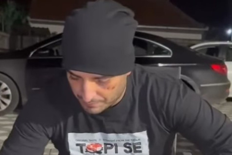 Darko Lazić posle udesa pravi kotlić u dvorištu: Masnice od povreda na oku mu još stoje!
