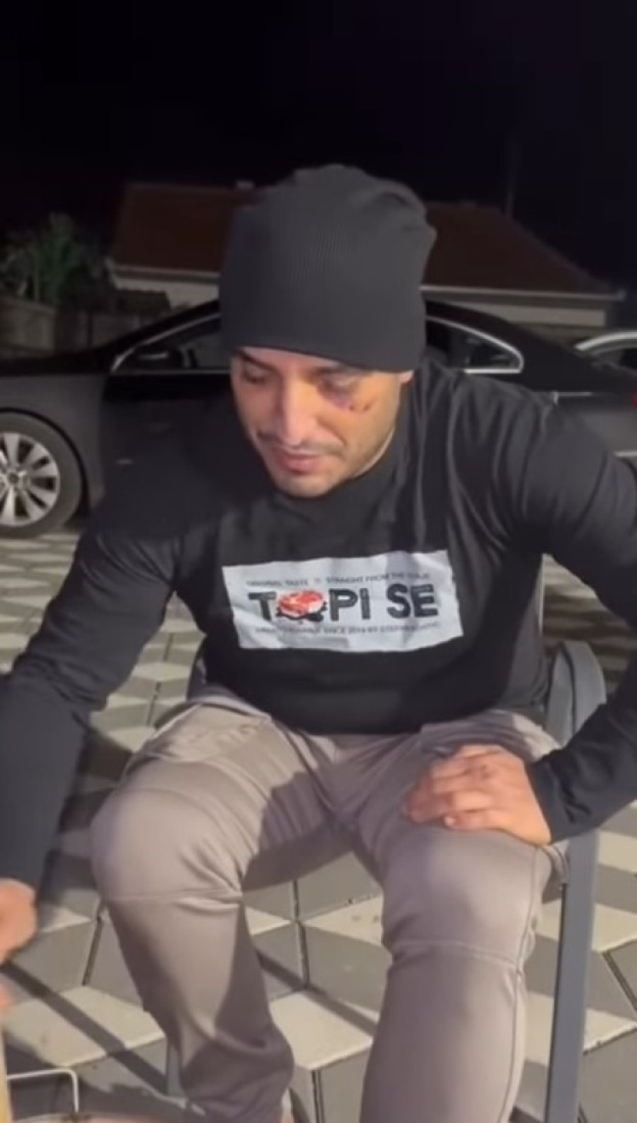 Darko Lazić posle udesa pravi kotlić u dvorištu: Masnice od povreda na oku mu još stoje!