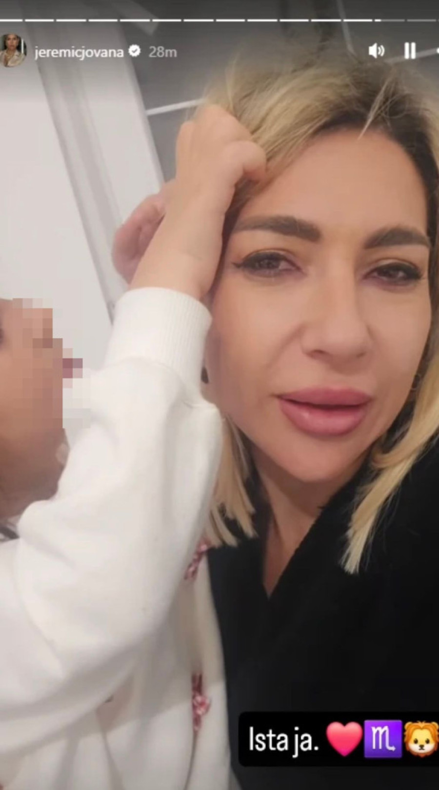 "Imala sam 6 masnih tkiva na glavi" Jovana Jeremić šokirala sve priznanjem o zdravlju