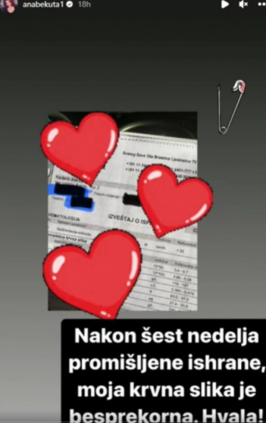 Ana Bekuta završila u bolnici: Poznato u kakvom je stanju pevačica