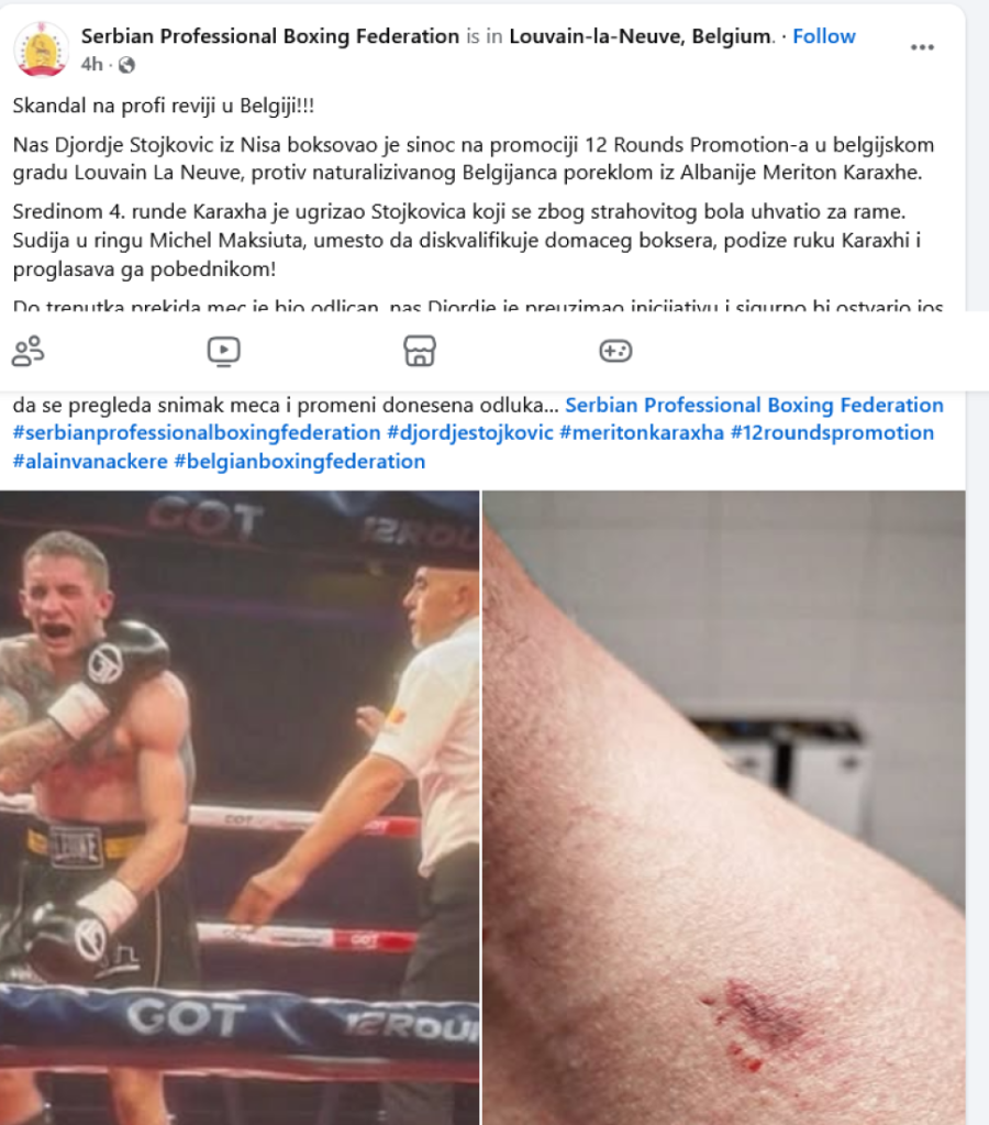 Skandal u Belgiji! Albanski bokser ugrizao Srbina, a zatim proglašen za pobednika?!