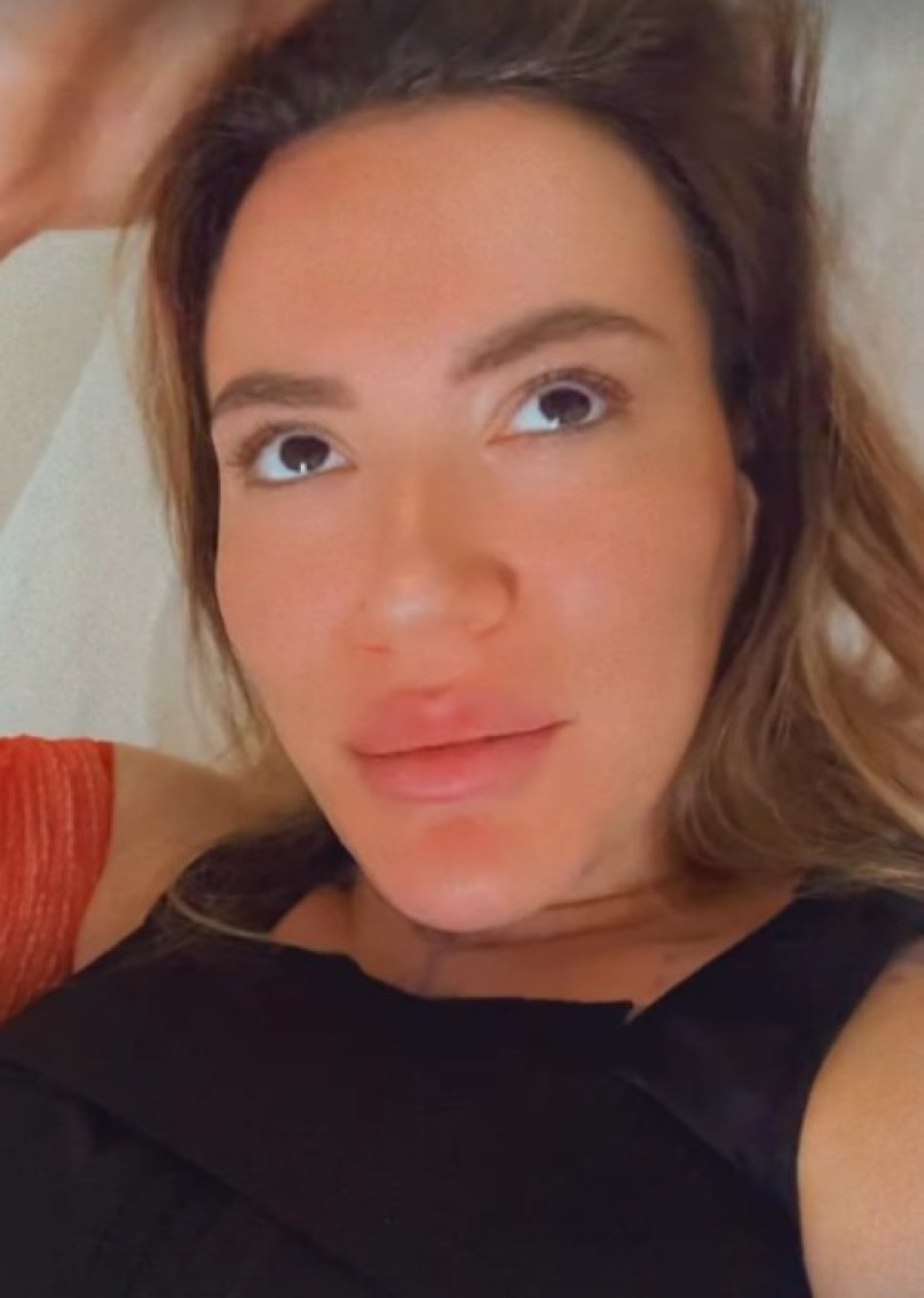 Kristina Spalević operisana: Podvrgla se ovim estetskim zahvatima istovremeno!