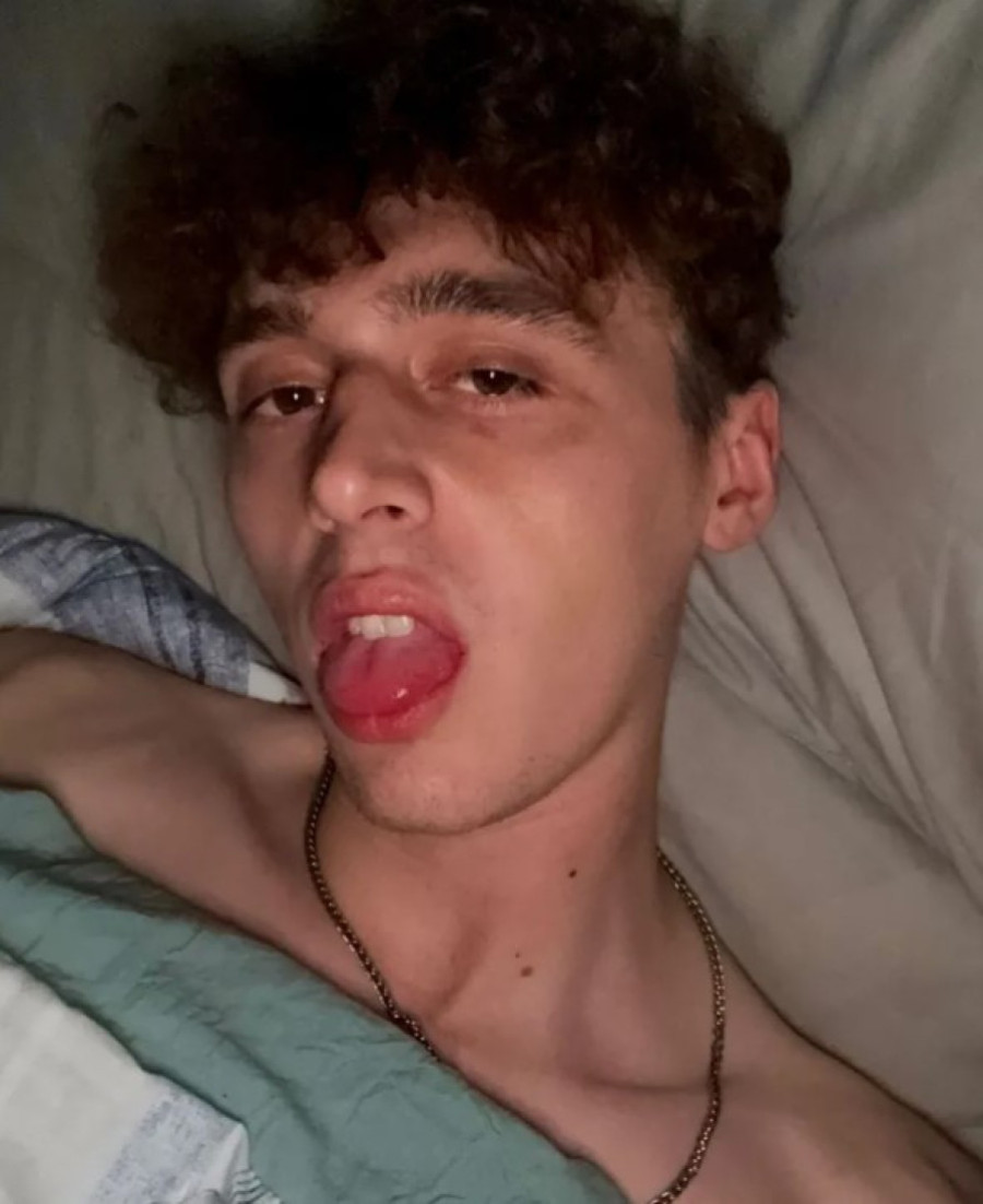 Pobednik "Velikog brata" pretučen: Sav je krvav i u podlivima (FOTO)