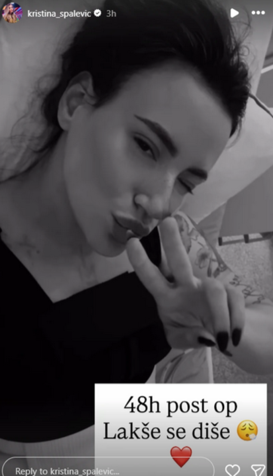 Ovako izgleda Kristina Spalević nakon operacija: Podelila sliku iz bolničke sobe (FOTO)