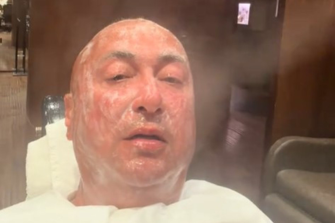 Đani otišao na podmlađivanje lica u Dubaiju! Iskeširao ogromne pare, evo kako izgleda sada!