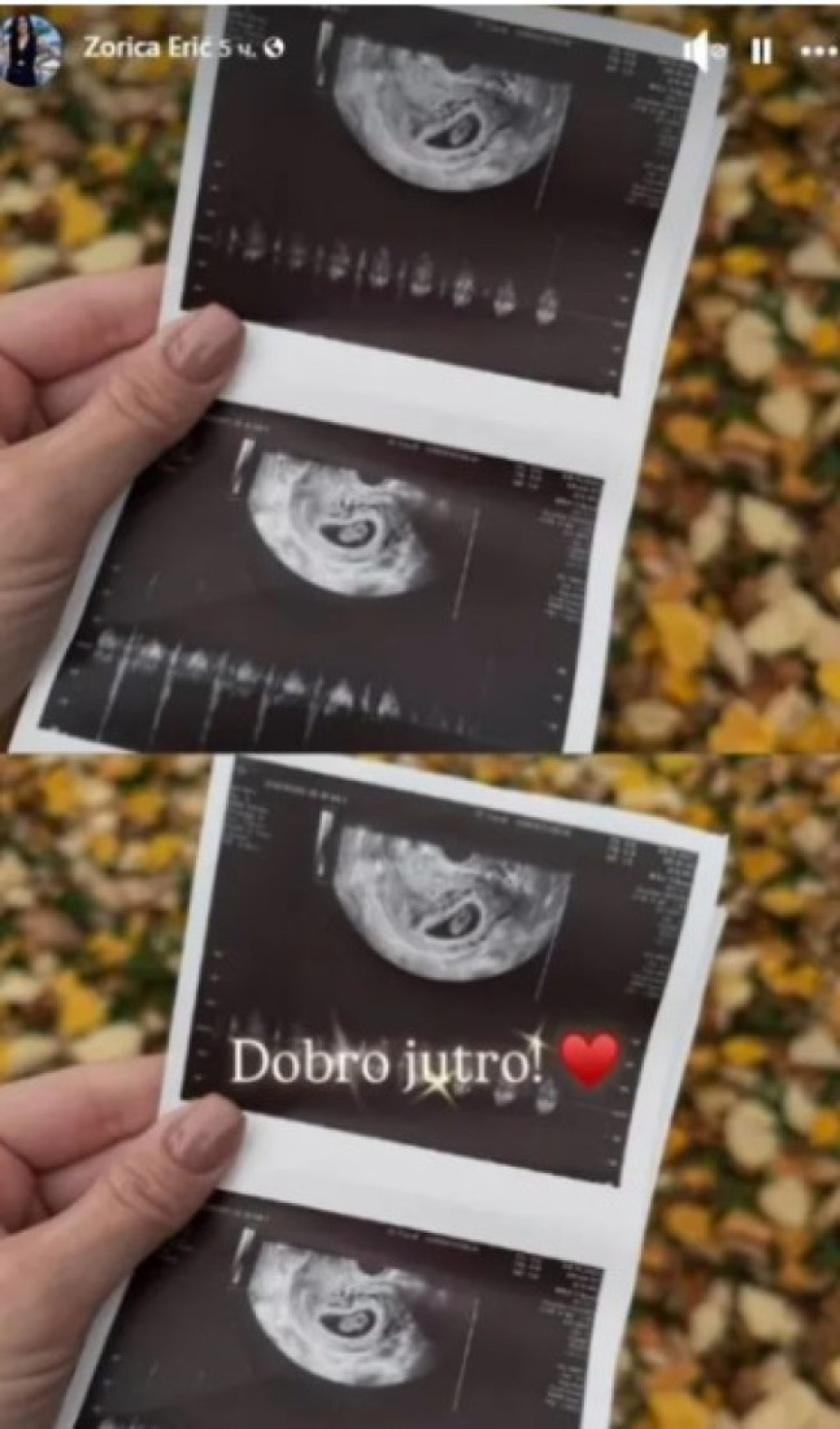 Pevačica (47) drugi put postaje baka: Bila u kandžama narkotika, a sad podelila radosne vesti