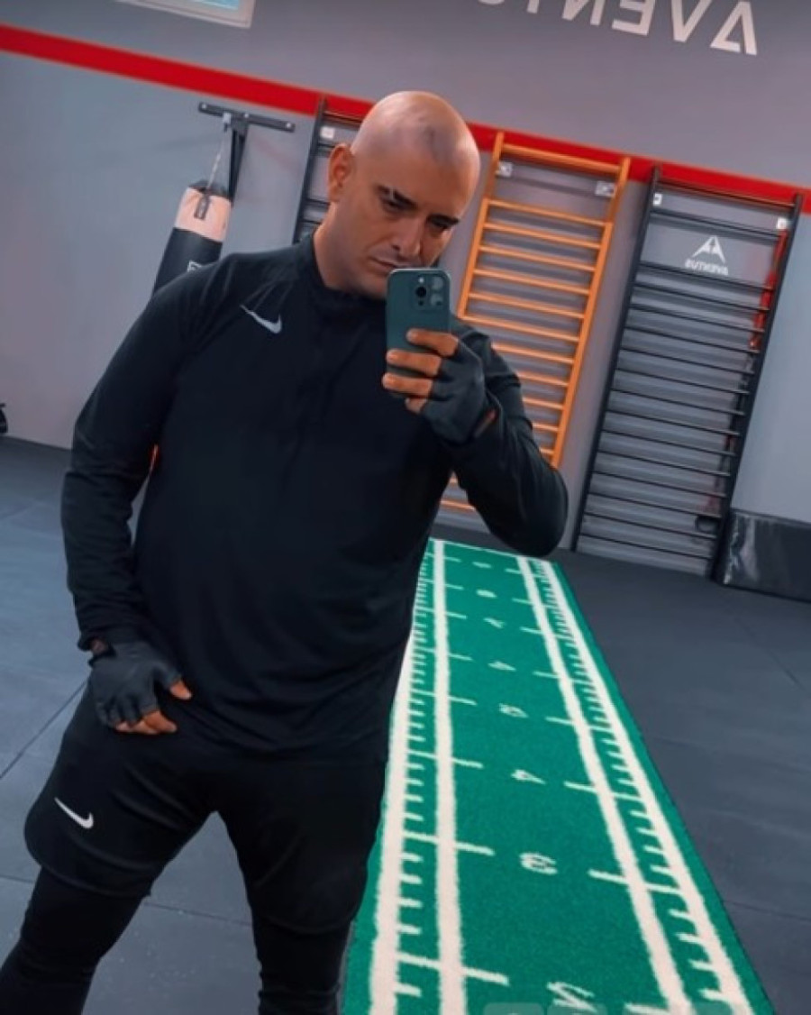 Darko Lazić se transformisao: Ošišao se na ćelavo, zjapi mu ožiljak od udesa! (FOTO)