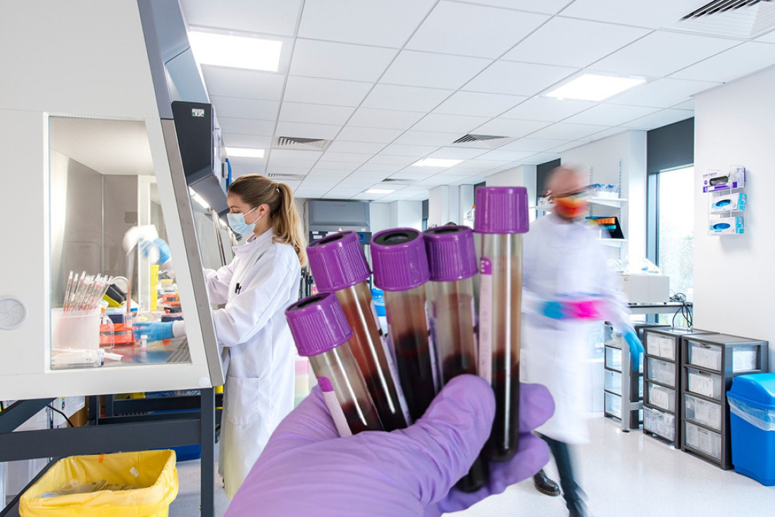 Doktori zabrinuti: Rak štitne žlezde se širi brže nego ikada – šta se dešava?