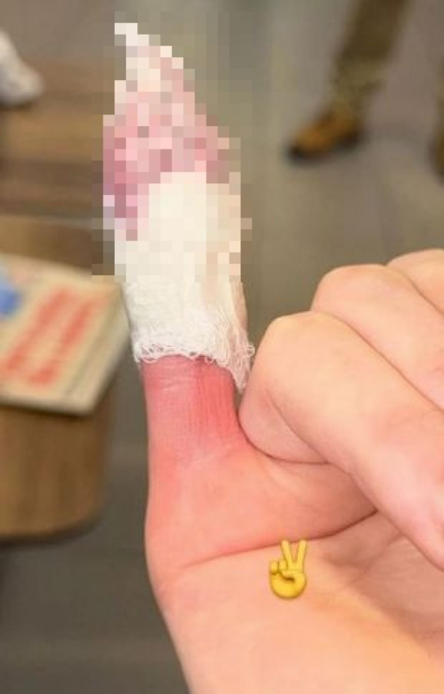 Jezivo, krv još probija kroz gazu! Fanovi zabrinuti za sina fudbalera (FOTO)