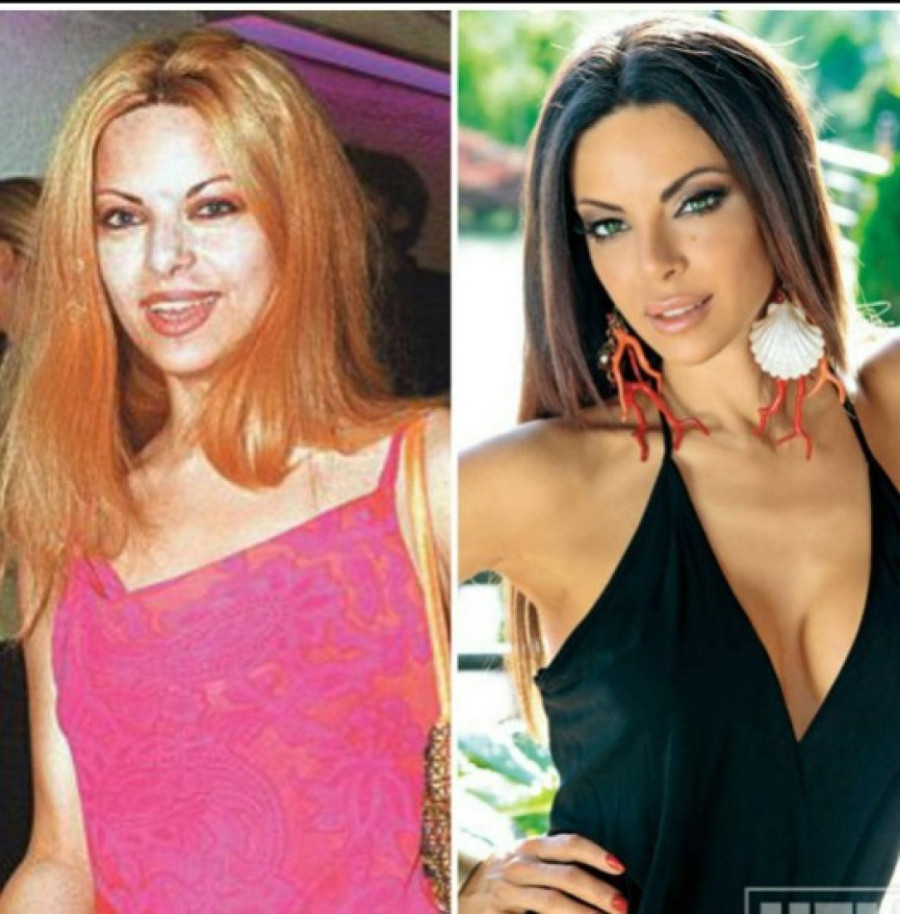 Nikolina Pišek sa početka karijere neprepoznatljiva: Danas ima holivudski osmeh, a uradila je i ove operacije