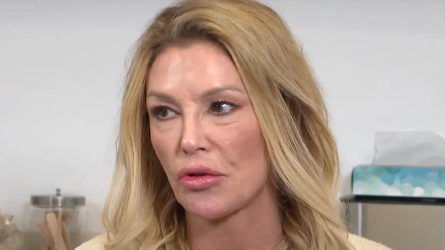 Rijaliti zvezda htela da se ulepša, pa rasekla lice naočigled svih: Šok snimak kruži mrežama! (VIDEO)