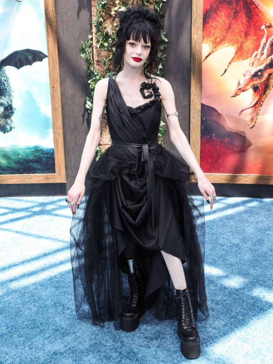 Poznatoj glumici amputirane obe noge: "Moj život se nikada neće poboljšati"