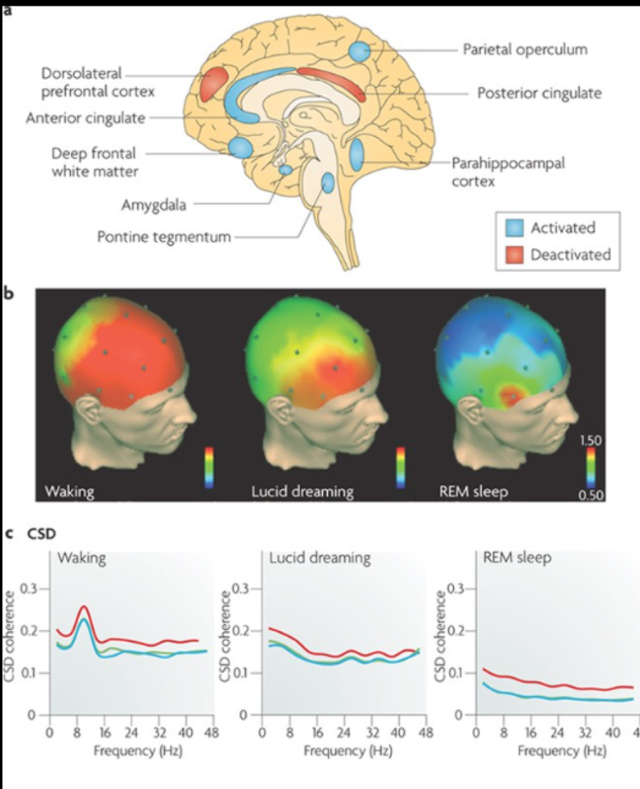 Ovih pet stvari nikada nećete videti u snovima