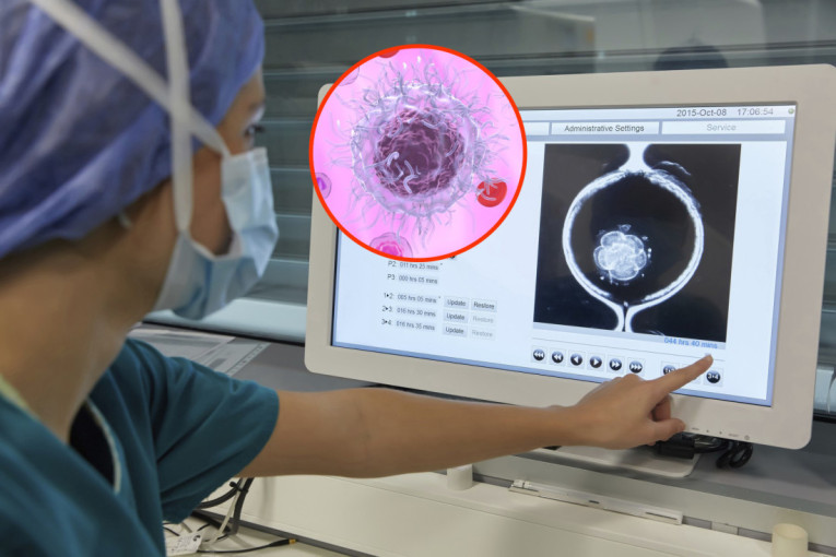 Skandal u Evropi: Semena tečnost donora sa "genom raka" korišćena za začeće 200 dece