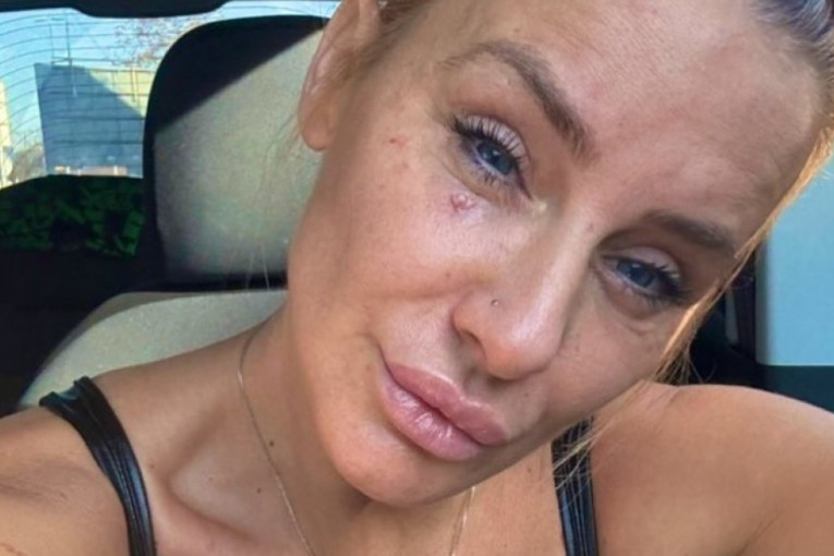 Operisana Milica Dabović: Posle 12 dana velikih bolova, zahvat prošao uspešno