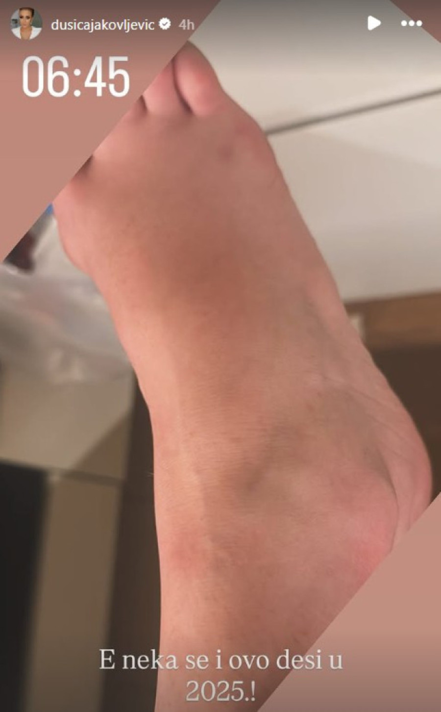 Dušica Jakovljević slavila rođendan, pa se povredila: Oglasila se u otocima! (FOTO)