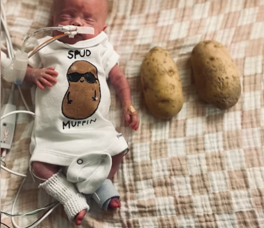 Kada se rodio, nije bio veći od očevog dlana i nije imao nikakve šanse da preživi: Rođen sa 283 grama,  danas ispisuje istoriju (FOTO)