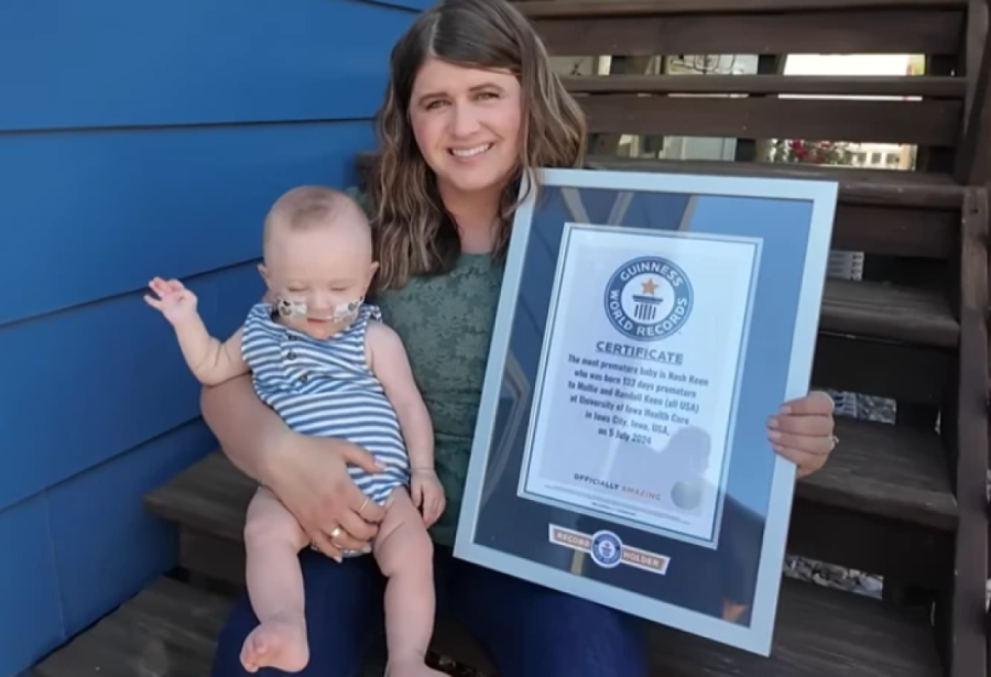 Kada se rodio, nije bio veći od očevog dlana i nije imao nikakve šanse da preživi: Rođen sa 283 grama,  danas ispisuje istoriju (FOTO)