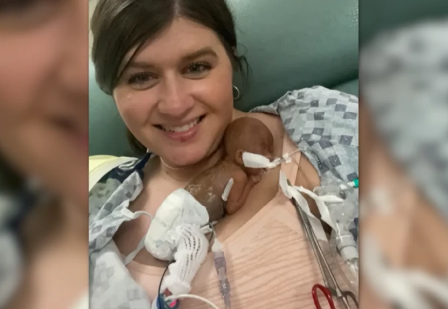 Kada se rodio, nije bio veći od očevog dlana i nije imao nikakve šanse da preživi: Rođen sa 283 grama,  danas ispisuje istoriju (FOTO)